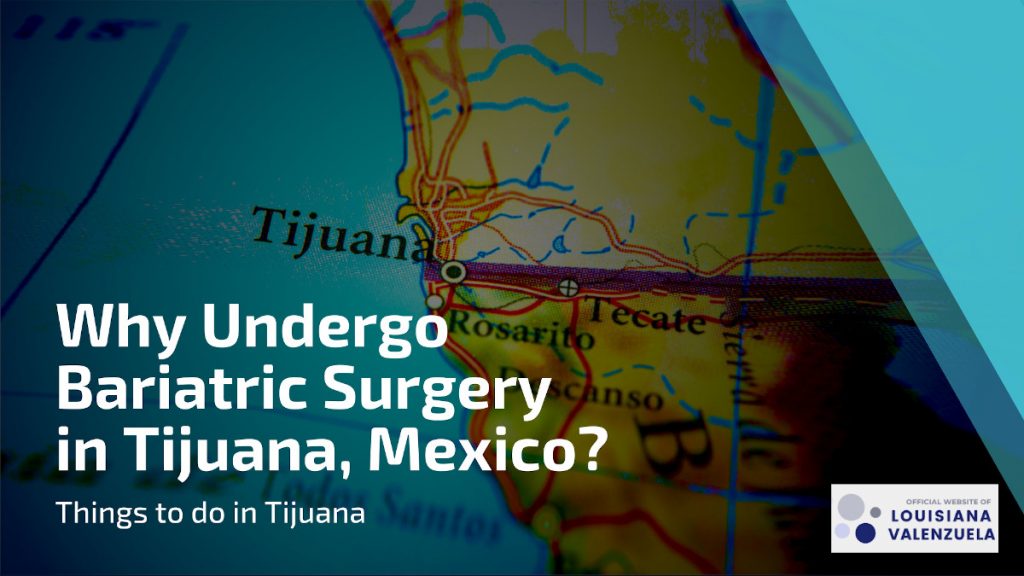 Why Choose Bariatric Surgery in Tijuana Mexico