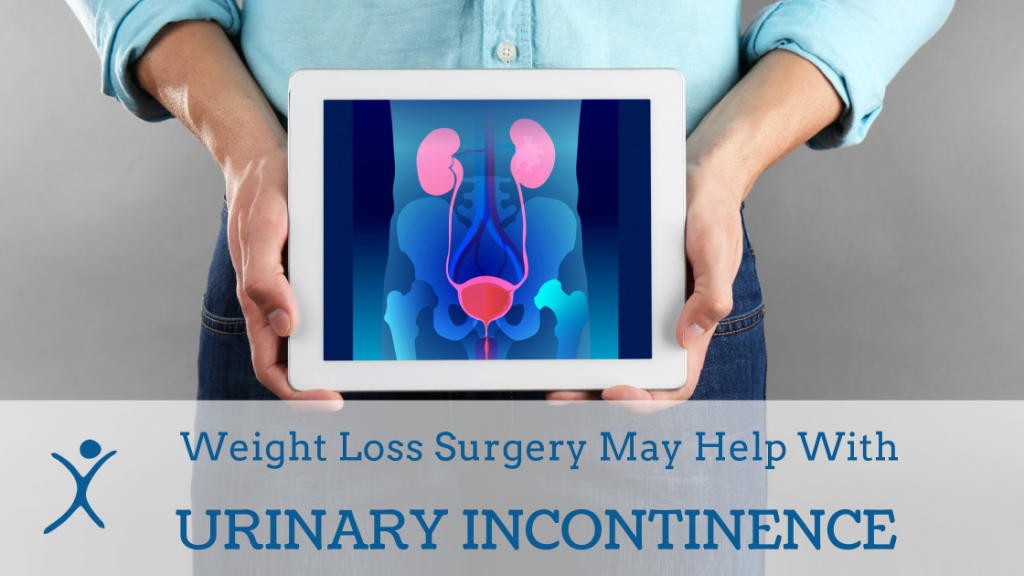 Weight Loss Surgery May Help With Urinary Incontinence