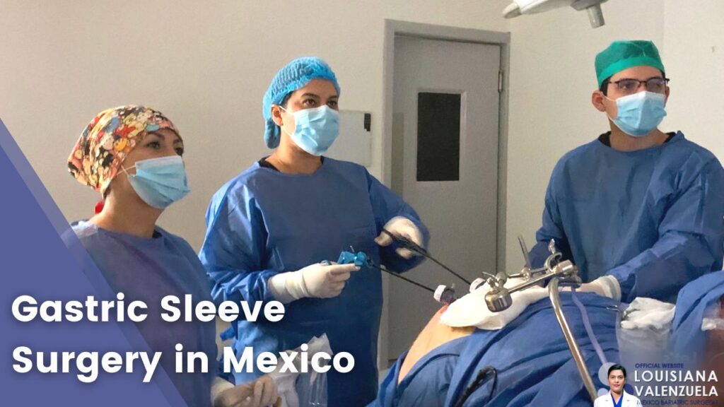 Gastric Sleeve Surgery in Mexico by Dr. Louisiana Valenzuela Surgeon