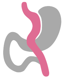Mini Gastric Bypass Stomach Icon