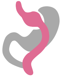 RNY Gastric Bypass - Stomach Icon