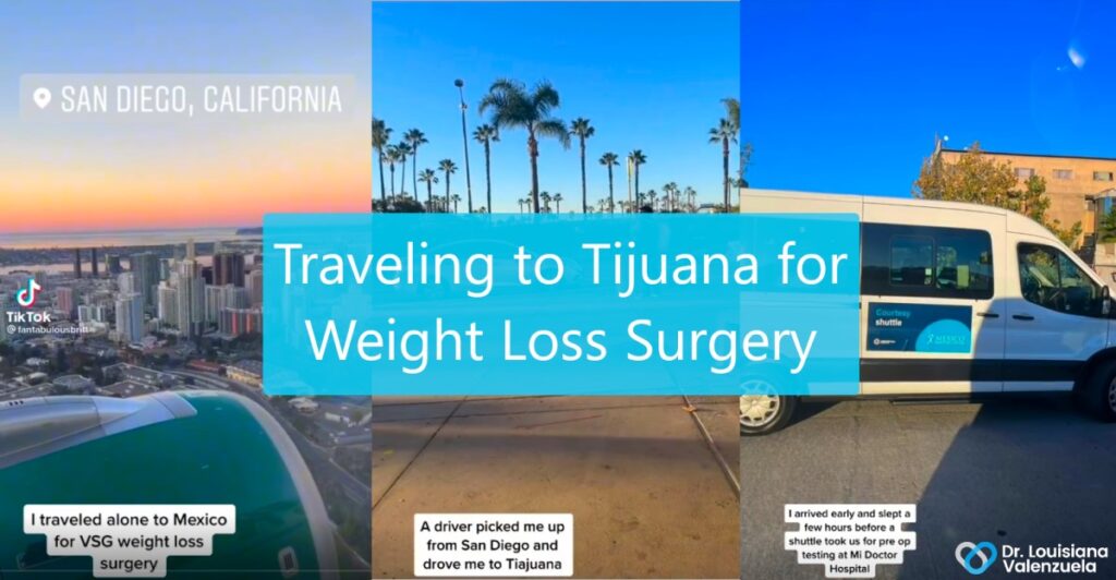 Traveling to Tijuana, Mexico for Weight Loss Surgery